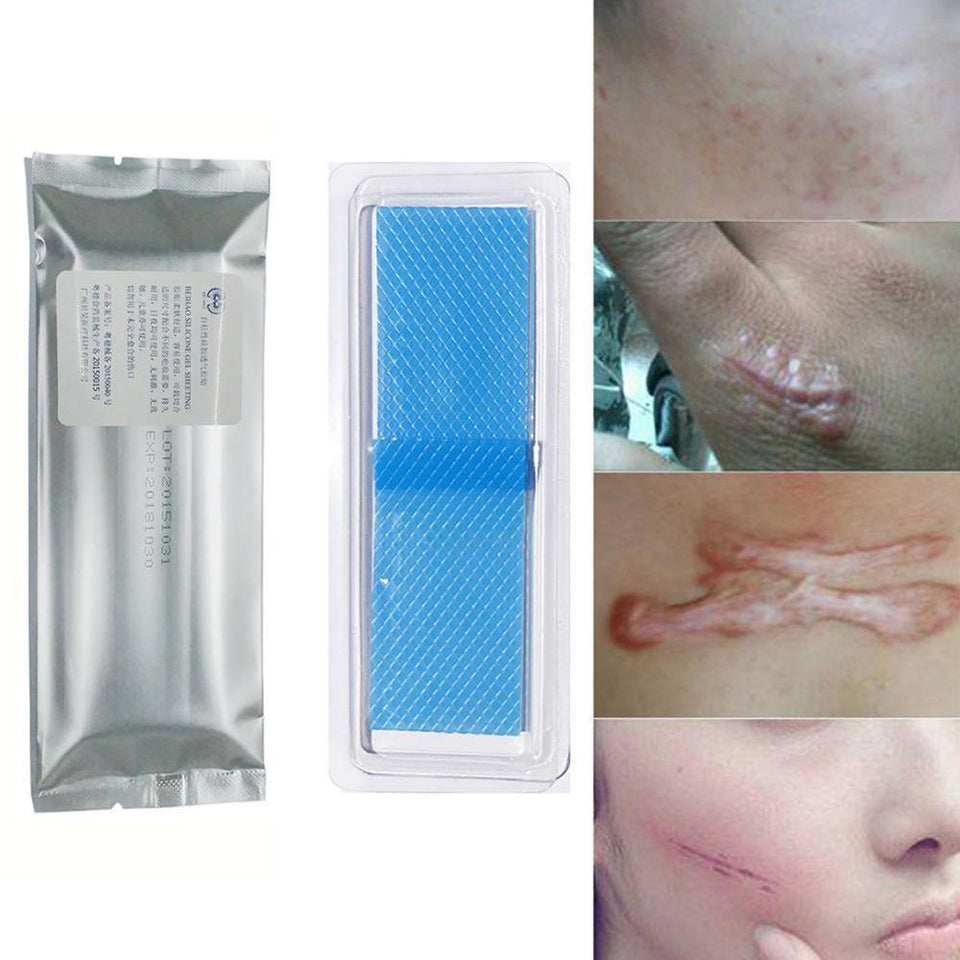 Scar Removal Silicone Sheets